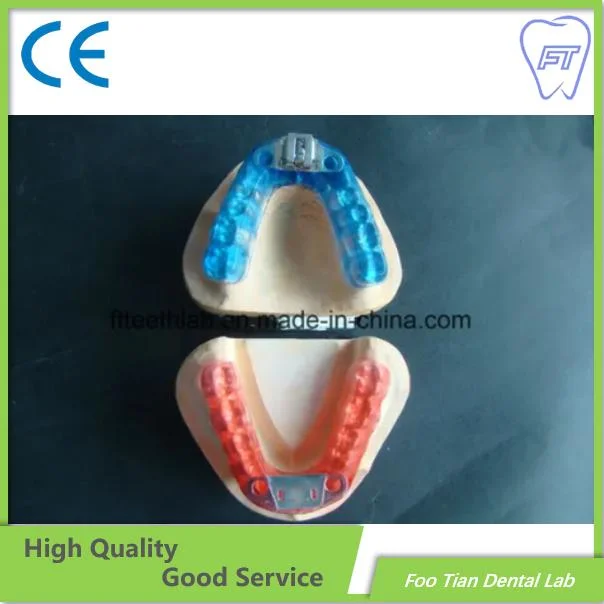 Factory Price Habit Breaker Thumb Appliance From China Dental Lab