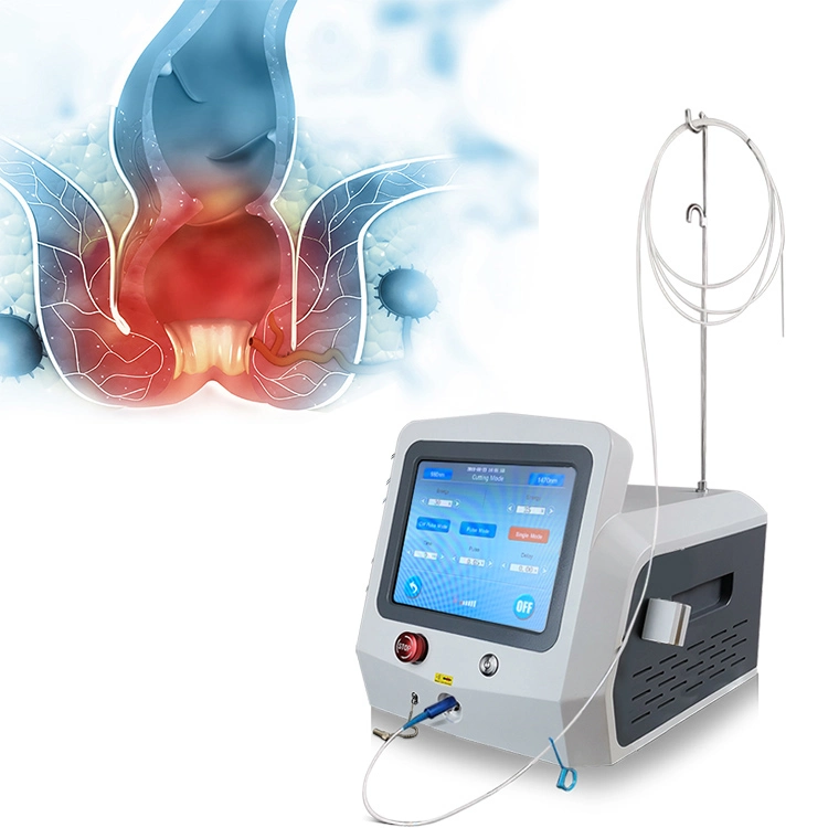 El mejor tratamiento con láser de diodo láser médico Cirugía de hemorroides con 980 Nm 1470 Nm Proctología