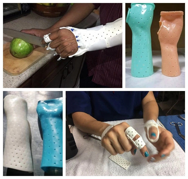 Low-Temperature Thermoplastic Sheet Medical Plastic Splint Material with High Conformability