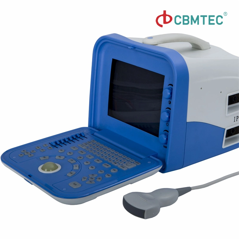 Factoty Wholesale/Supplier High quality/High cost performance Portable Ultrasound Scanner