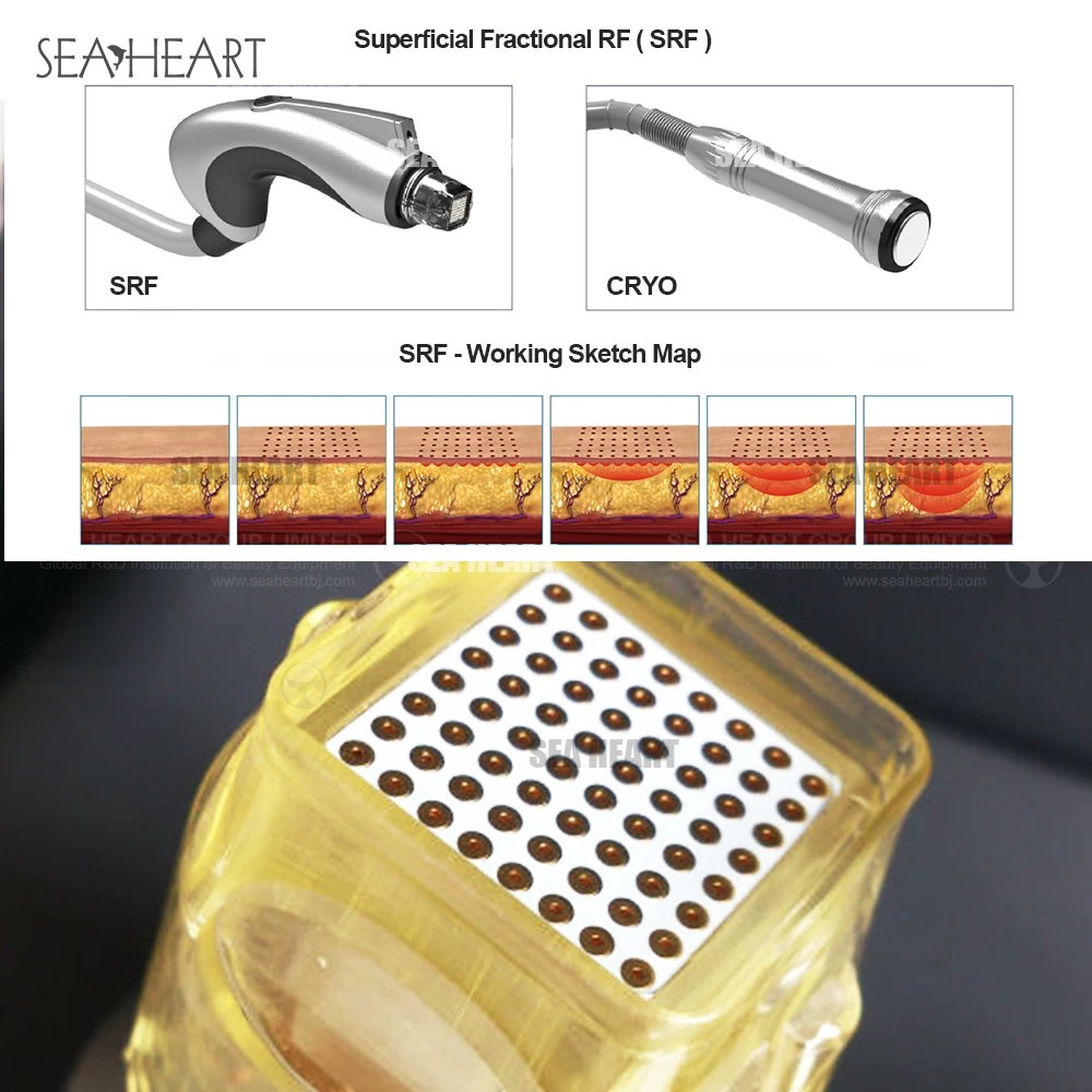 Precios baratos de frecuencias de radio de Oro de la belleza Cuidado de piel para el rostro Microneedle