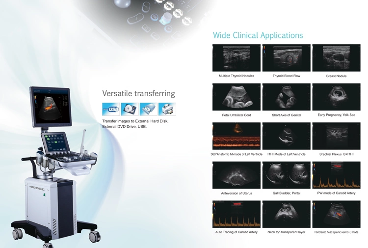 My-A030f Medical Iagnosis Equipment Color Doppler Full Digital Ultrasound Scanner Machine