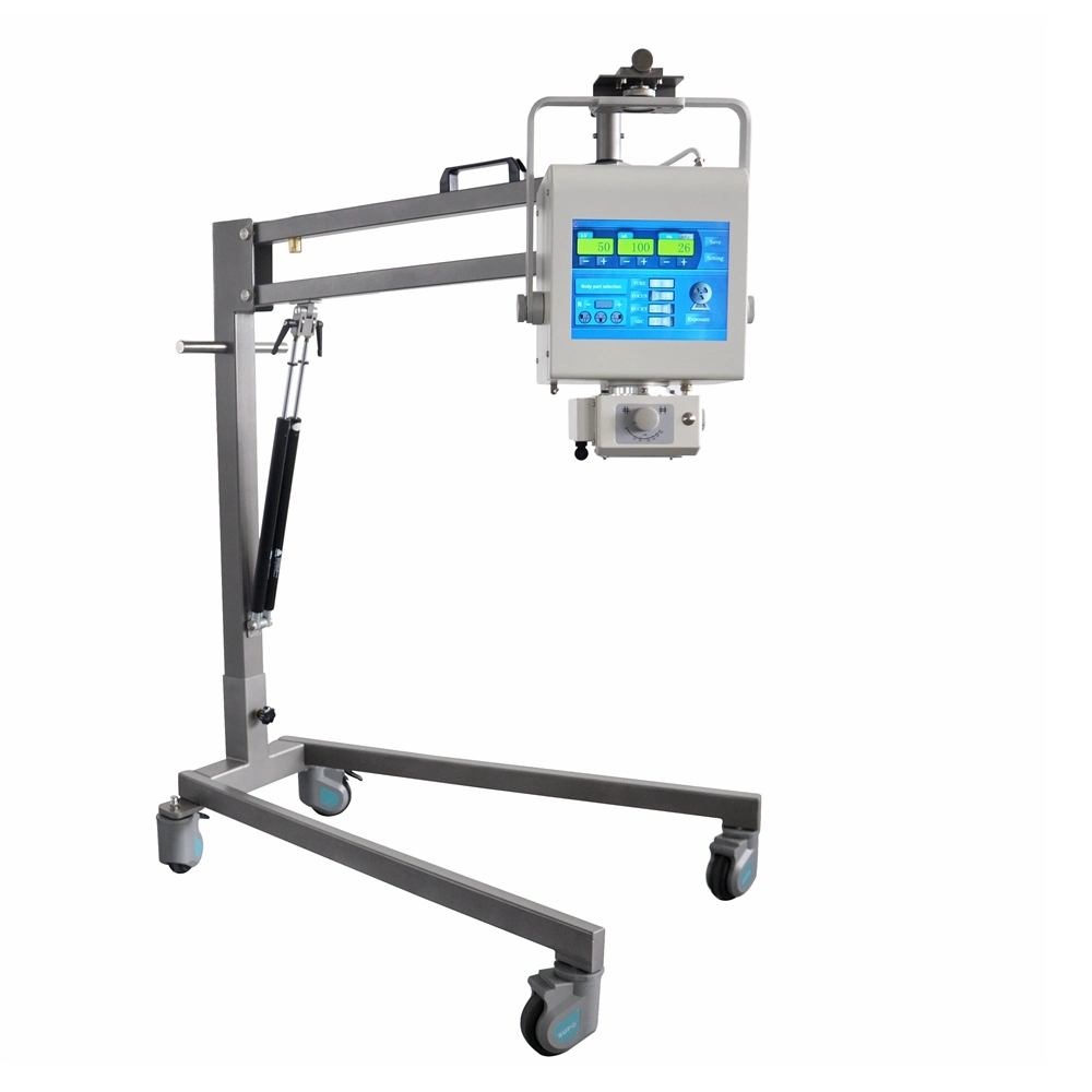 Portable Mobile Analog X-ray System Portable X-ray Machine for Human