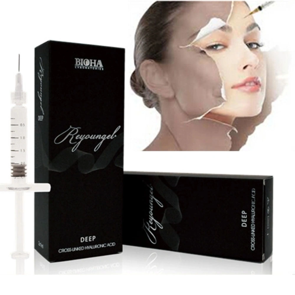 Reyoungel Hyaluronic Acid Injectable 1ml 2ml Dermal Filler for Lip Cheek Chin Injection