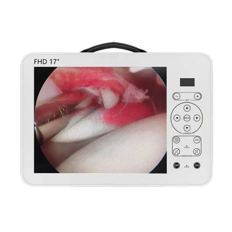 Medical Ent Endoscopy Equipment Digital Surgical Fiberscope Portable HD Ent USB Endoscope Camera