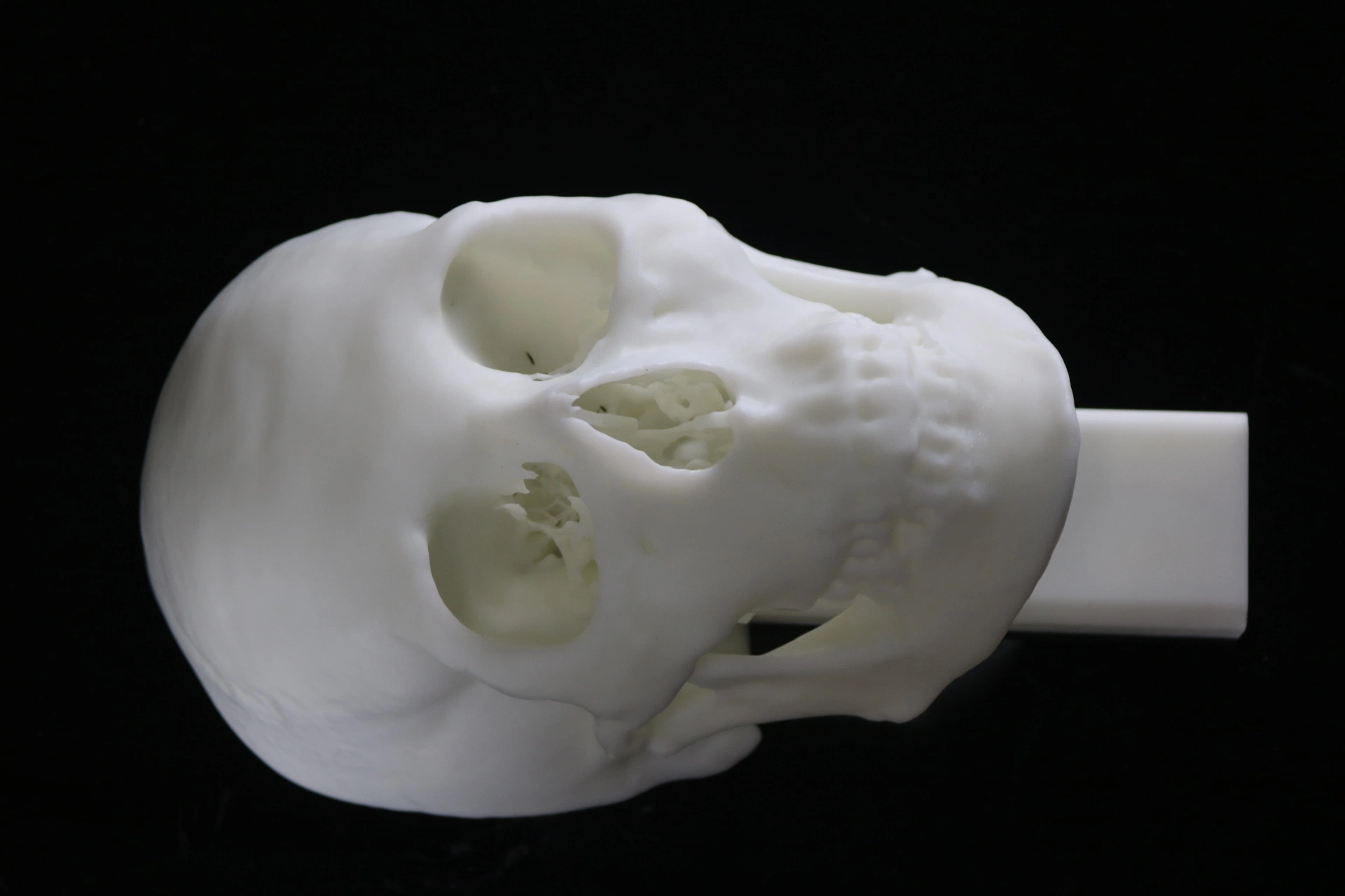 3D Printing SLA Resin Material Skull Preoperative Planning, Medical