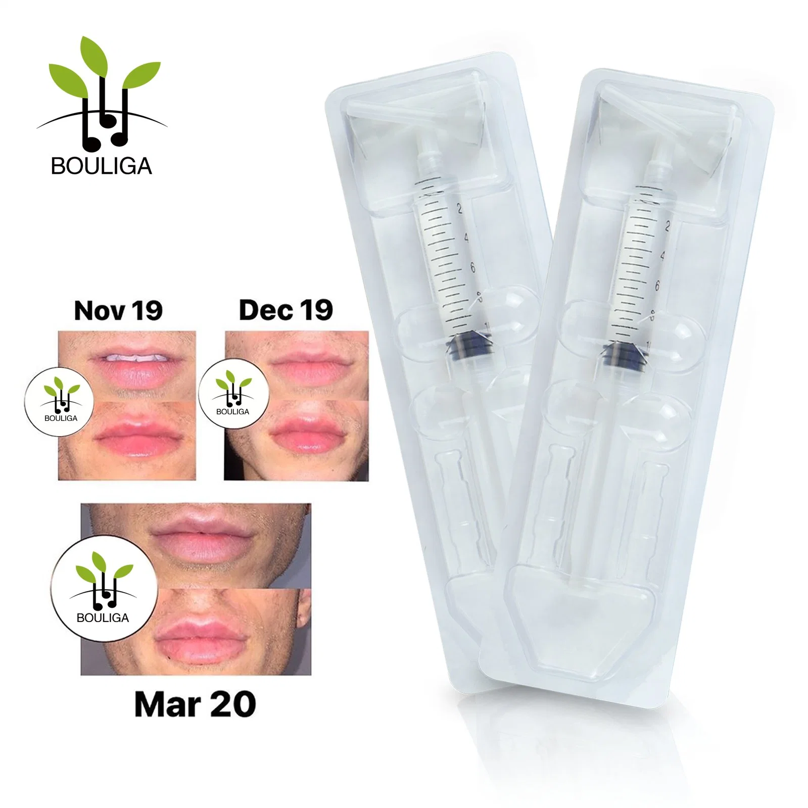 Bouliga Cross Linked Ha 10ml Recommend You Our Top-Rated Dermal Filler for Lips