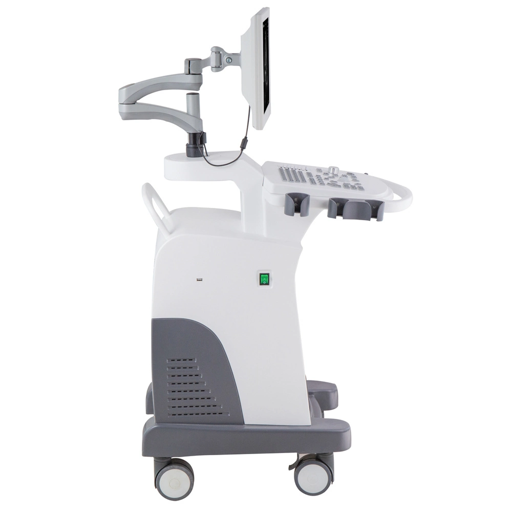 Trolley Type PC Based Vaginal B/W Mode Ultrasound Diagnostic System