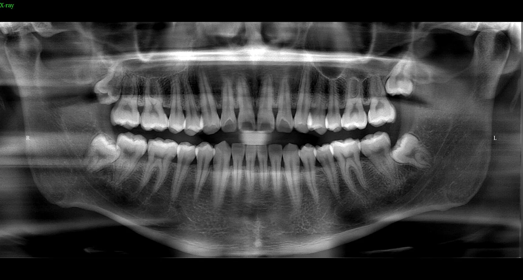 Cheap Price 3D Dental Cbct X Ray Machine with Ceph for Hospital Dental Clinic