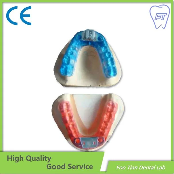 Good Product Habit Breaker Thumb Appliance From China Dental Lab