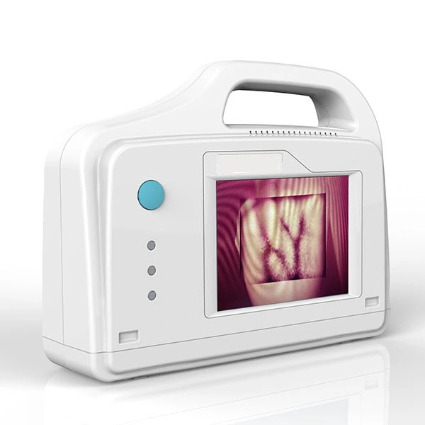 Infrared Portable Vein Locator Vein Detector