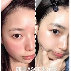 Korea New Asce+Srlv Stem Cell Exosome Premium Skincare Fights Aging and Eliminates Acne Marks and Dull Blemishes Asce Plus