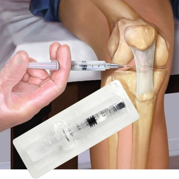 Gel de inyección de ácido Hialurónico intraarticular en las articulaciones de rodilla para Inyección de osteoartritis