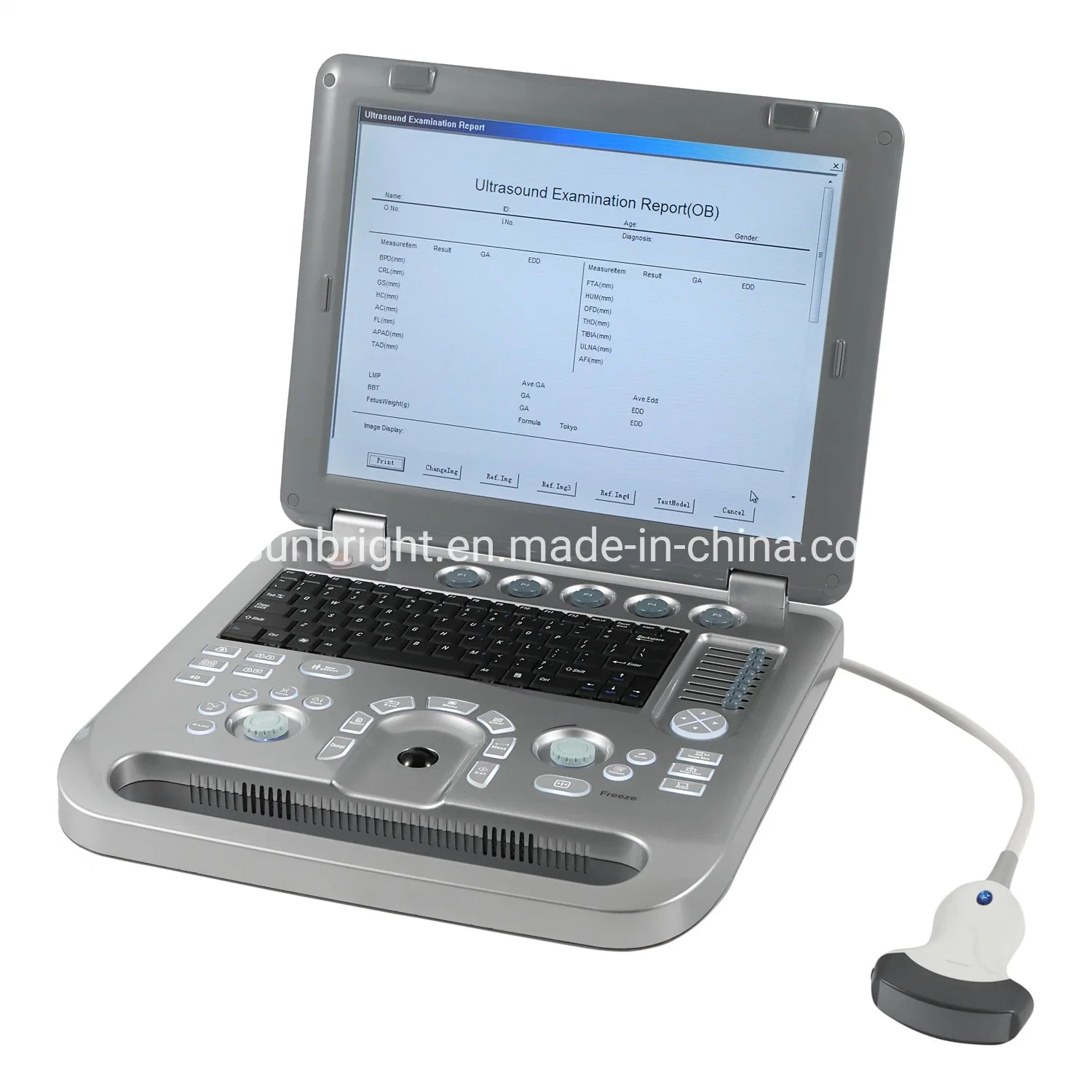 Full Digital B Mode Ultrasound Doppler 3D Medical Ultrasound Machine Diagnostic System