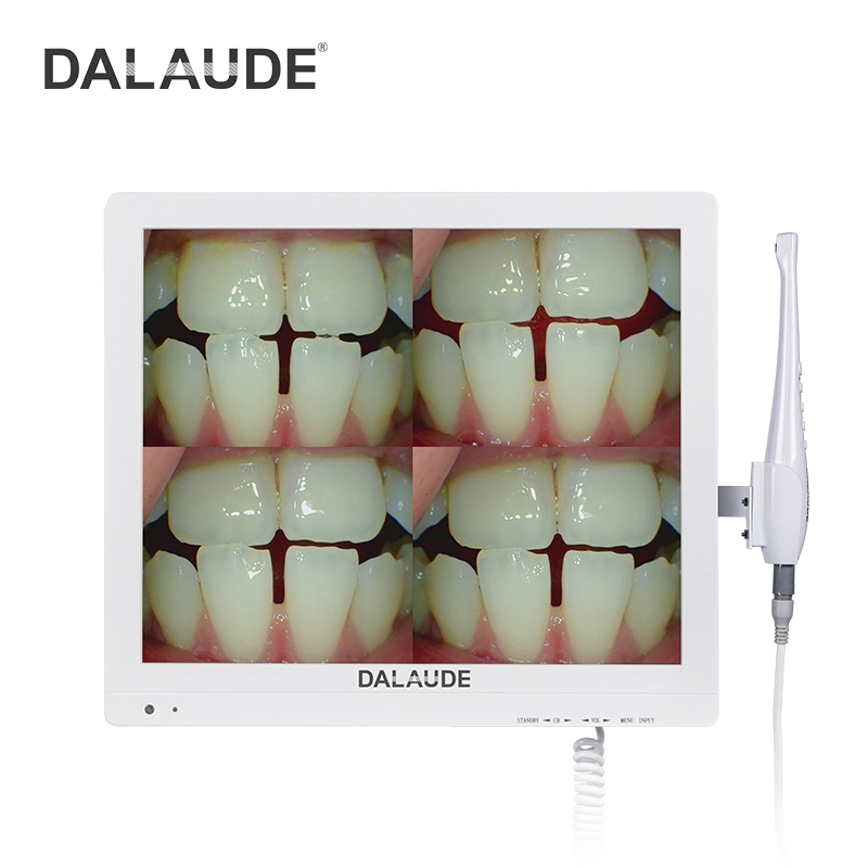 Dental Camera with WiFi Wireless Transfer Pictures and Metal Arm