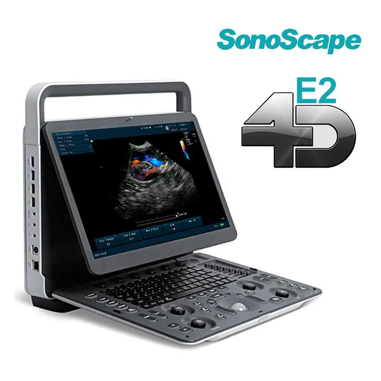 2023 Instrumento de ultrasonido médico Medsinglong Msk Ob/Gyn 3D 4D 5D Escáner de ultrasonido Máquina de ultrasonido portátil Sonoscape E2.