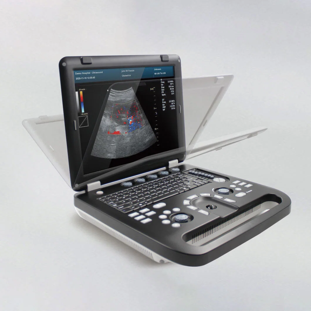 High quality/High cost performance Laptop Portable Color Doppler Ultrasound Scanner