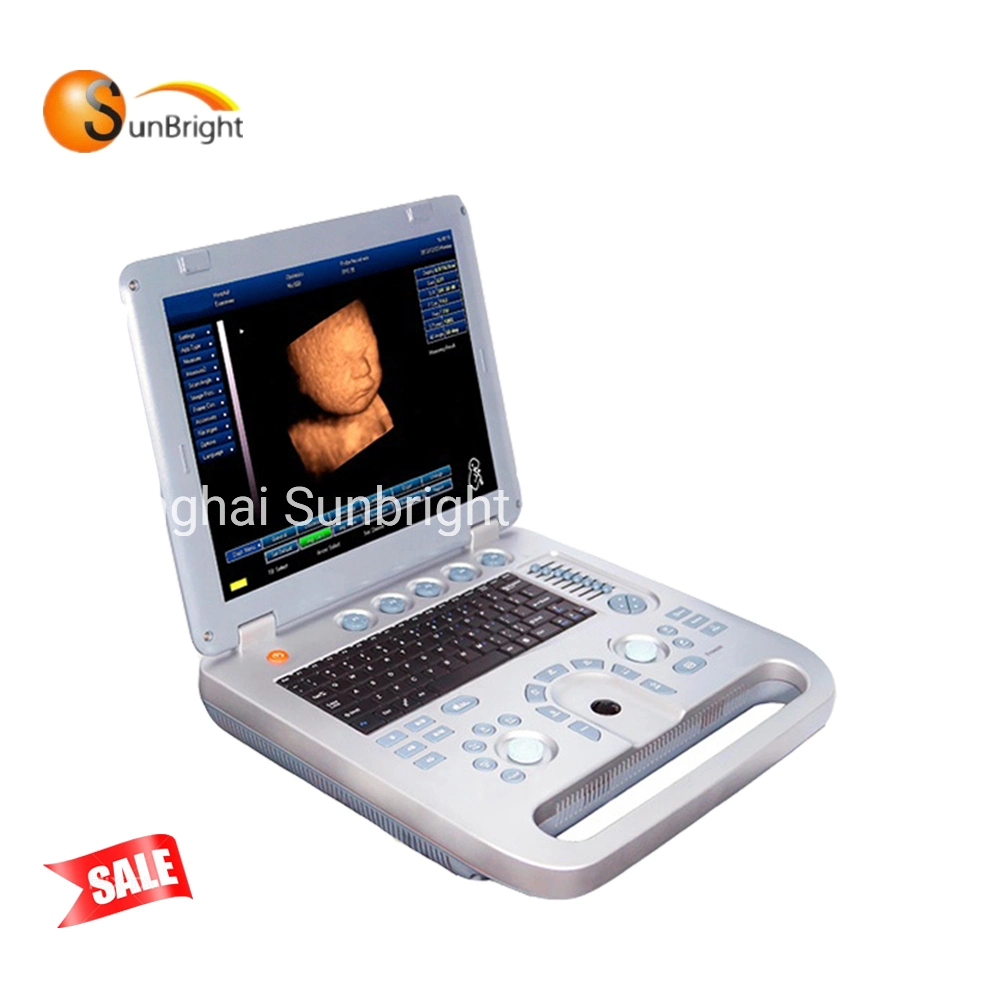 Last Promotion Ultrasound Machine Sun 800d Star Product