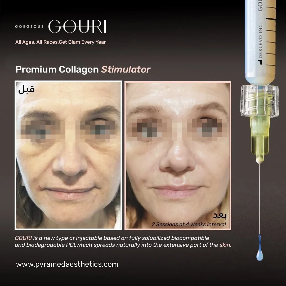 CE stimulateur ISO La FDA a approuvé le collagène Gouri PCL Polycaprolactone Gouri de remplissage de liquide injectable