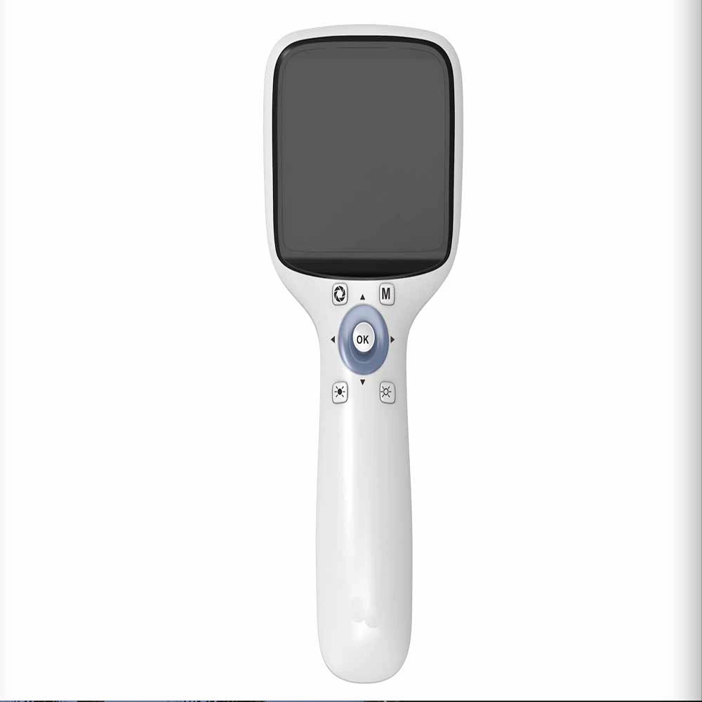 Visual Field Analyzer Eye Vision Exanimation Handheld Fundus Camera