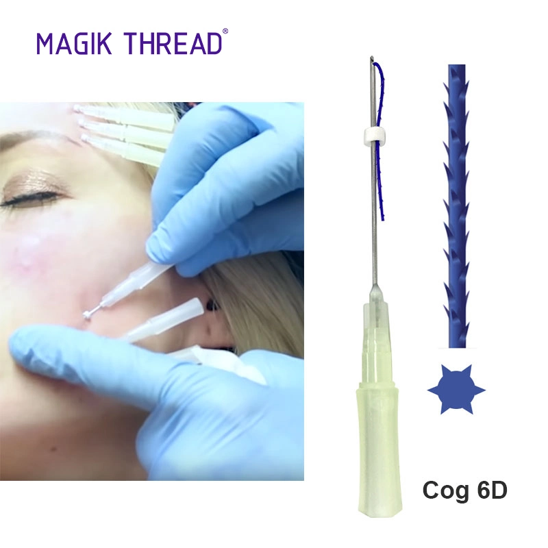 Pdo Thread Lifting Fios De Pdo Needle Hilos Tensores 3D 4D Cog Nasolabial Folds Lift