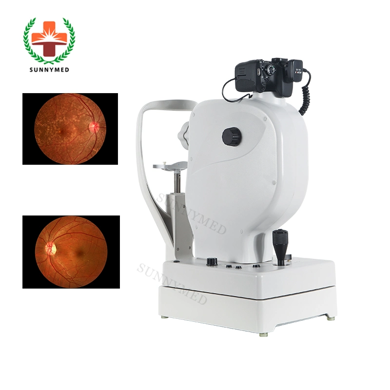 Sy-V036c CE/FDA oftálmico Fundus equipo automático de la cámara Non-Mydriatic fondo de ojo de la Cámara de venta