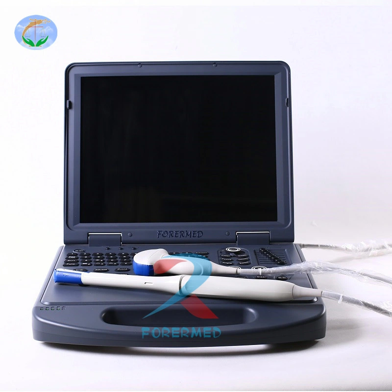 Médico de ultrasonido portátil 4D con CE y ISO