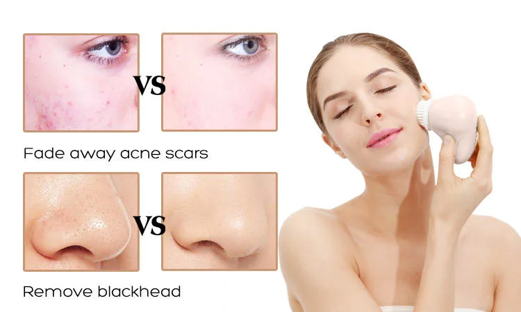 Brosse nettoyante pour le visage brosse à maquillage nettoyant à ultrasons utilisation à domicile Équipement de beauté