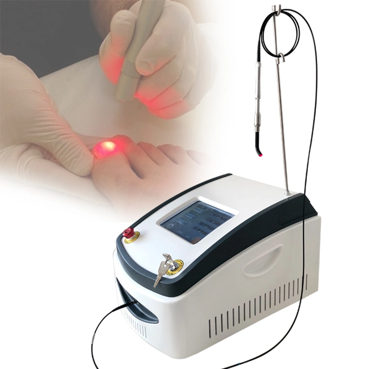 Best Sale 980nm Diode Laser Nails Pilz Behandlung Physiotherapie Plantar Entfernen Von Warzen