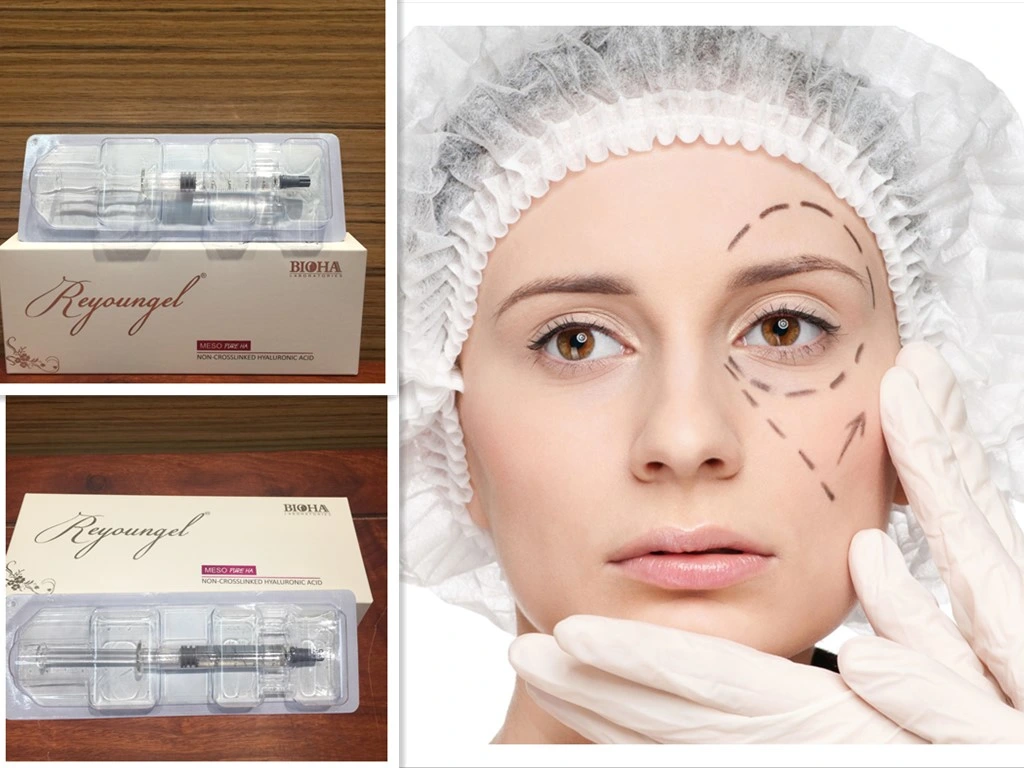Non Crosslinked Hyaluronic Acid Can Be Injected Ha Solution for Mesotherapy