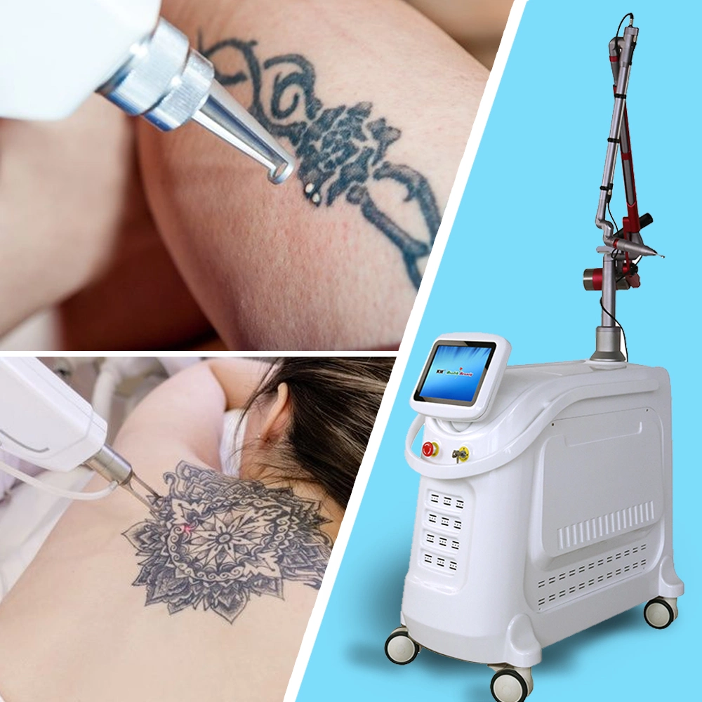 Q Switched ND YAG Laser Tattoo Removal / Picosecond Laser Machine with Korea Laser Arm