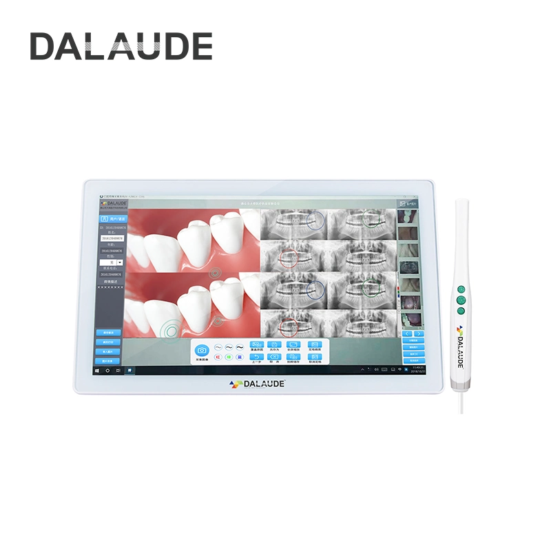 Equipamento dentário Computador Touchscreen Câmera Intraoral Definição
