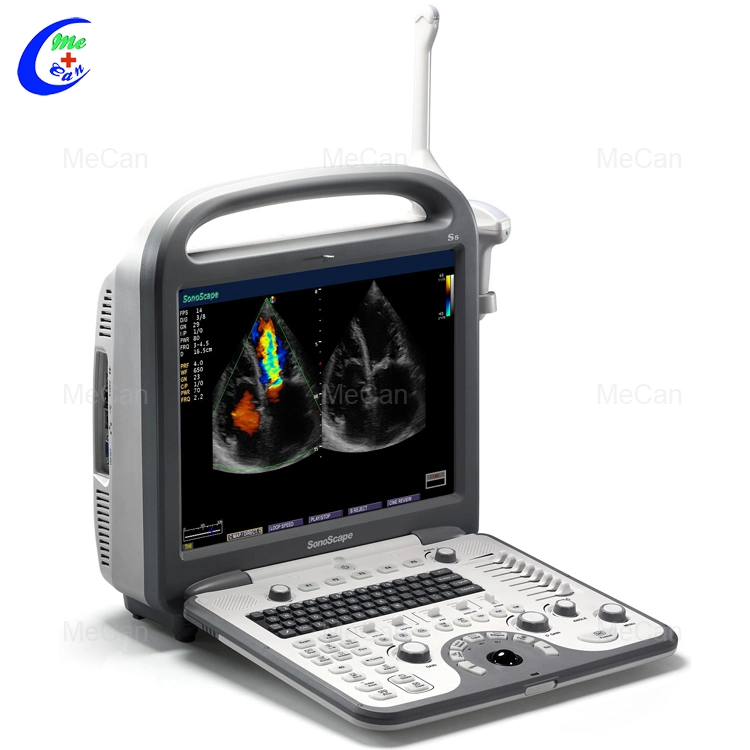 Sonoscape S6 Cardiac 4D Color Doppler Echo Ultrasound Machine with Pw Cw