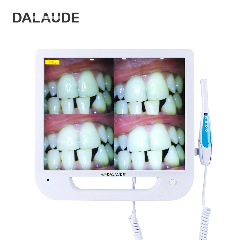 Monitor LCD de 17 pulgadas, cámara intraoral digital de alta definición de 10 megapíxeles con conexión VGA y endoscopio multimedia