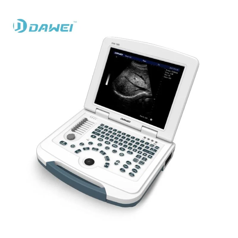 Dw-580 Hot Selling Portable Full Digital Black and White Ultrasound System