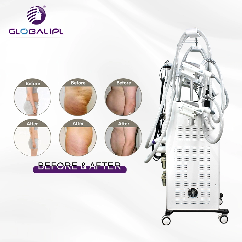 Cryolipolysis multifuncional RF cavitación Lipolaser congelar 360 Fat Body Shaping la belleza de la máquina de adelgazamiento