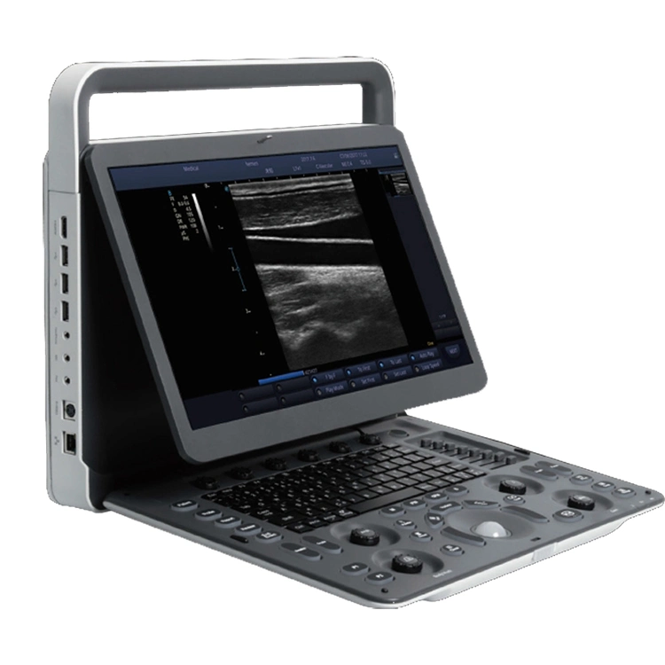 New Black &amp; White Portable Veterinary Ultrasound Machine /Sonoscape E1V /Portable Ultrasound