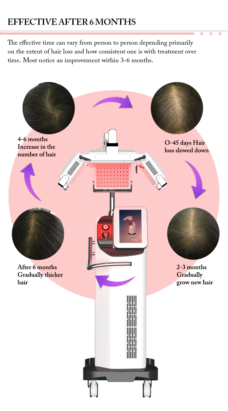 Diode laser de faible niveau de thérapie de perte de cheveux de cheveux de laser Laser périphérique casque de la repousse des poils Soins des cheveux Anti-Hair Thérapie de la perte de la machine la repousse des poils