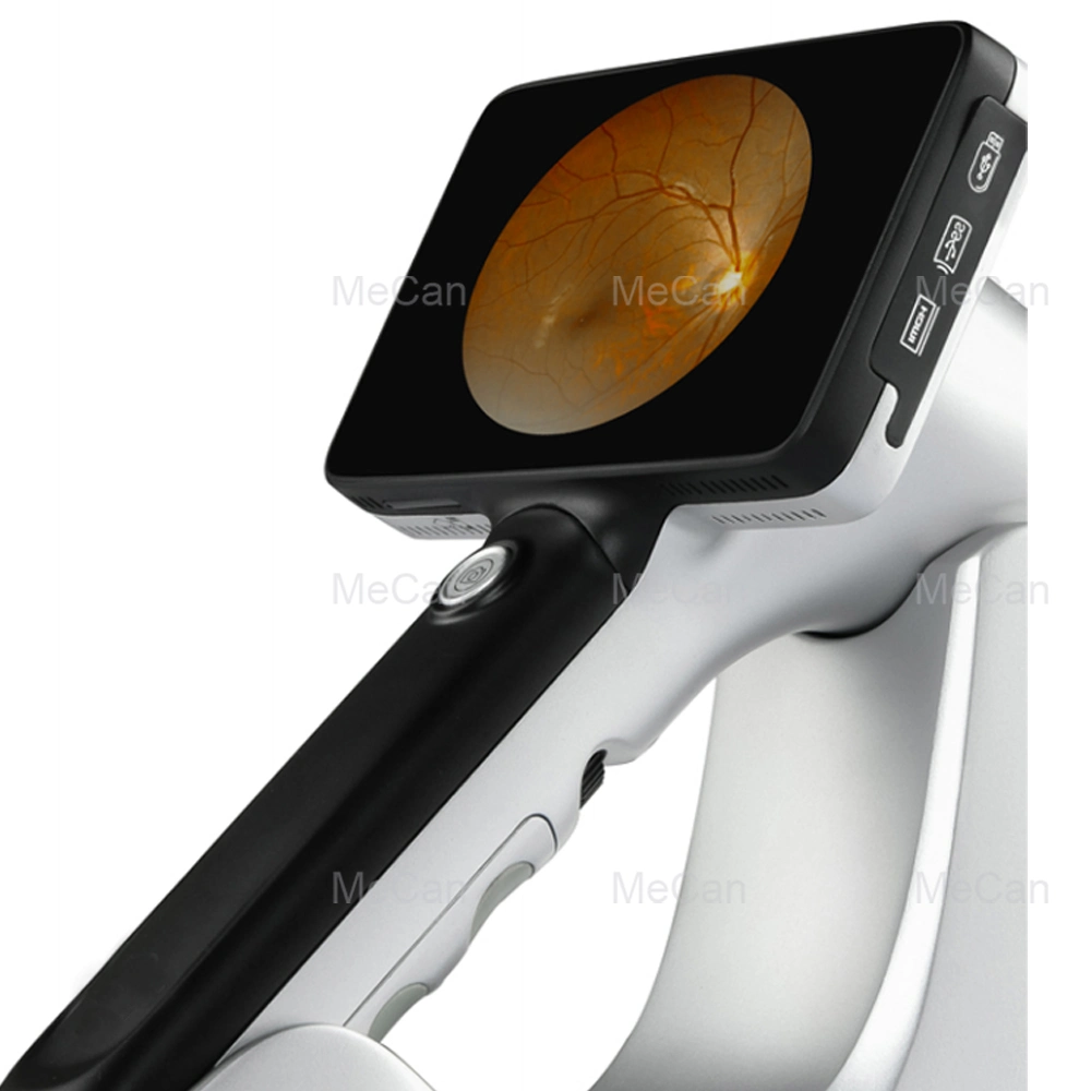 Cámara portátil portátil Eye Price smartphone Fundus de mano