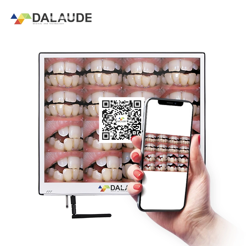 Metal Casing Ultrathin Monitor with HD Intraoral Camera, Dental Equipment