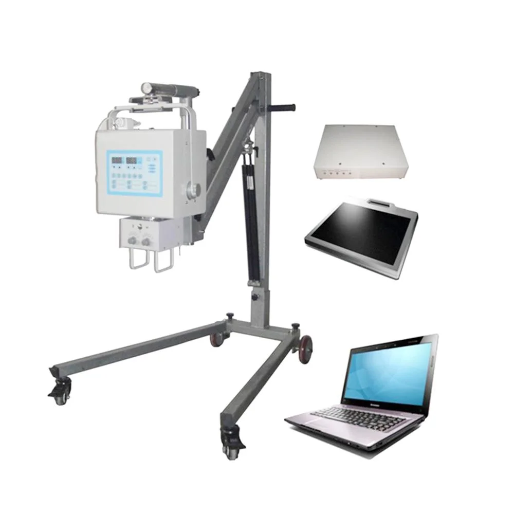 المعدات الطبية الأشعة السينية الطبية الرقمية عالية التردد 4 كيلو واط Mini Portable X جهاز الأشعة مع نظام DR