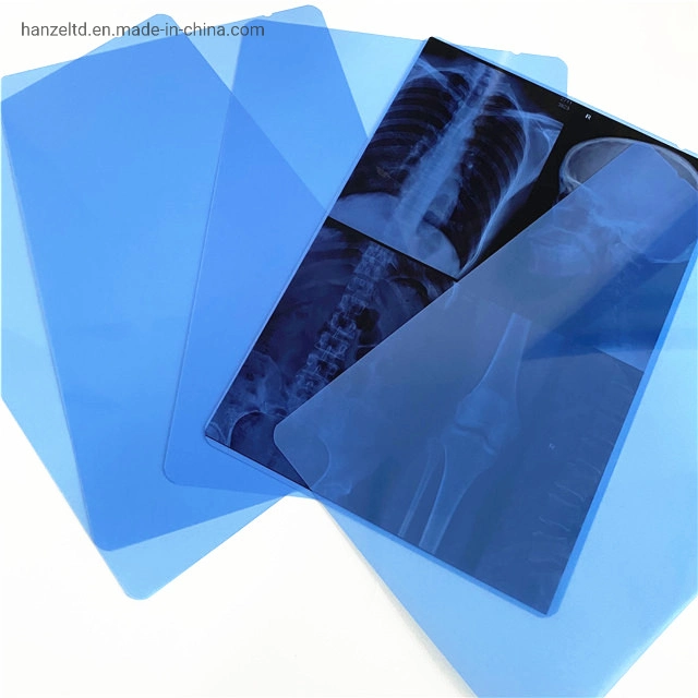 غشاء طبي Blue XRay Dry Clear Inkjet مقاوم للمياه خاص بالطابعة