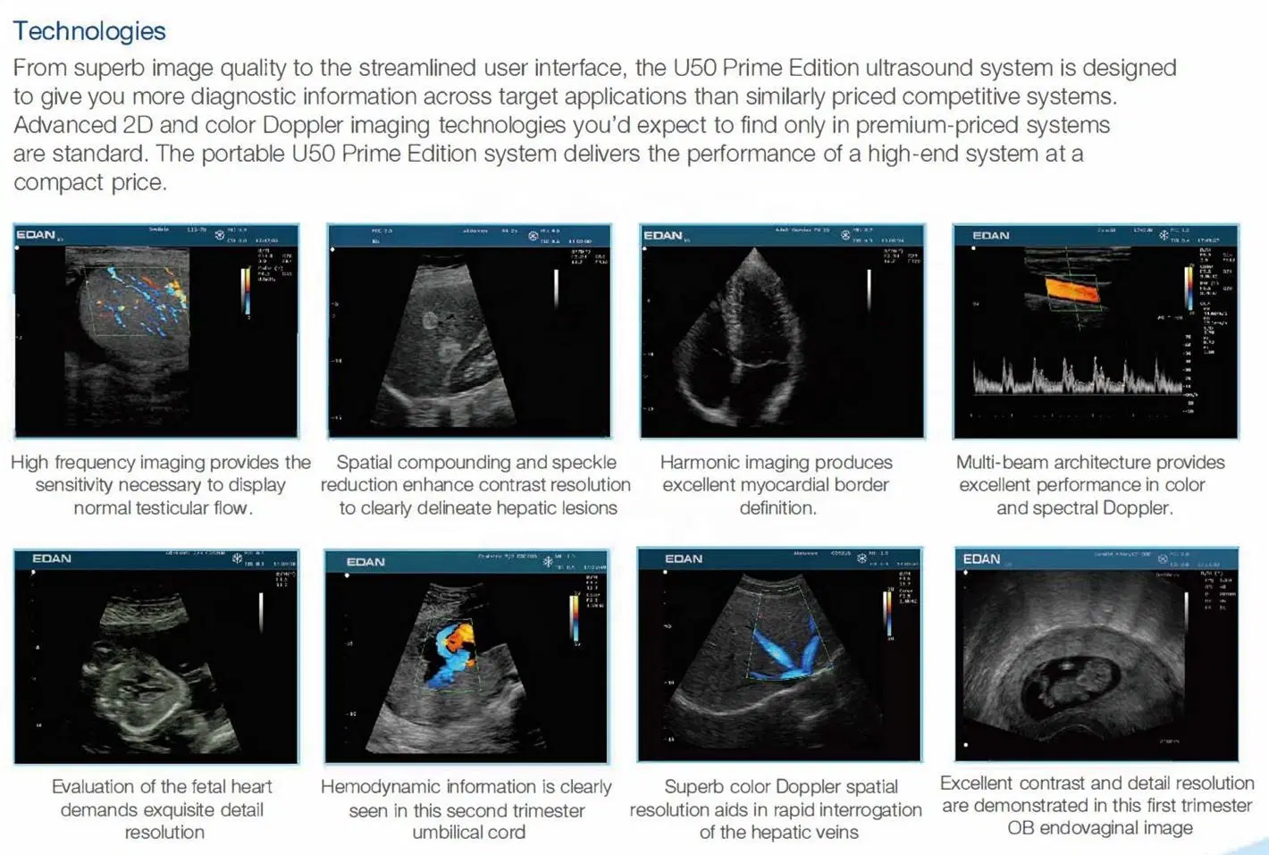 Edan U50 12.1 Inch Portable Color Doppler Ultrasound