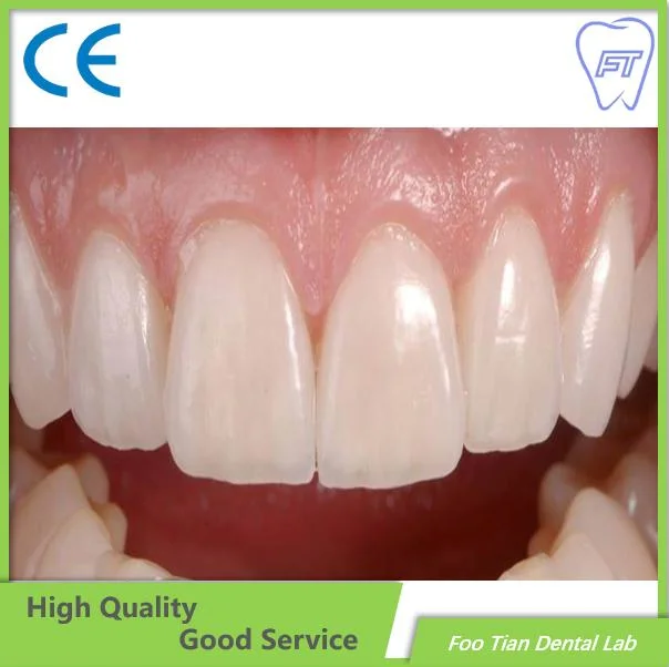 Dental Lab Zirconia Crown Made From China with High Aesthetic and Natural on Selling