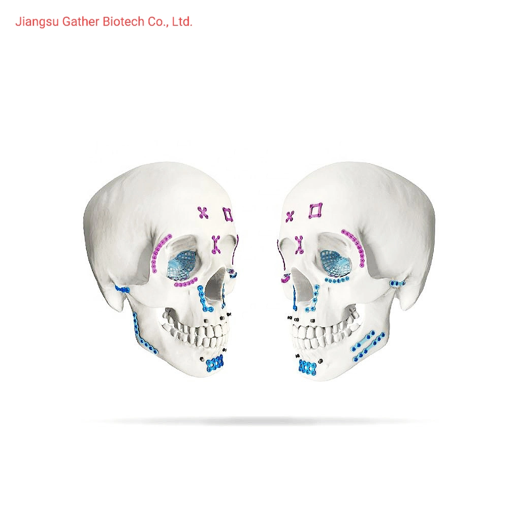 Le traumatisme du crâne Orthopedic Implants maxillo-faciale de la plaque de forme Y 1.5mm 0.6mm Épaisseur mini vis à vis