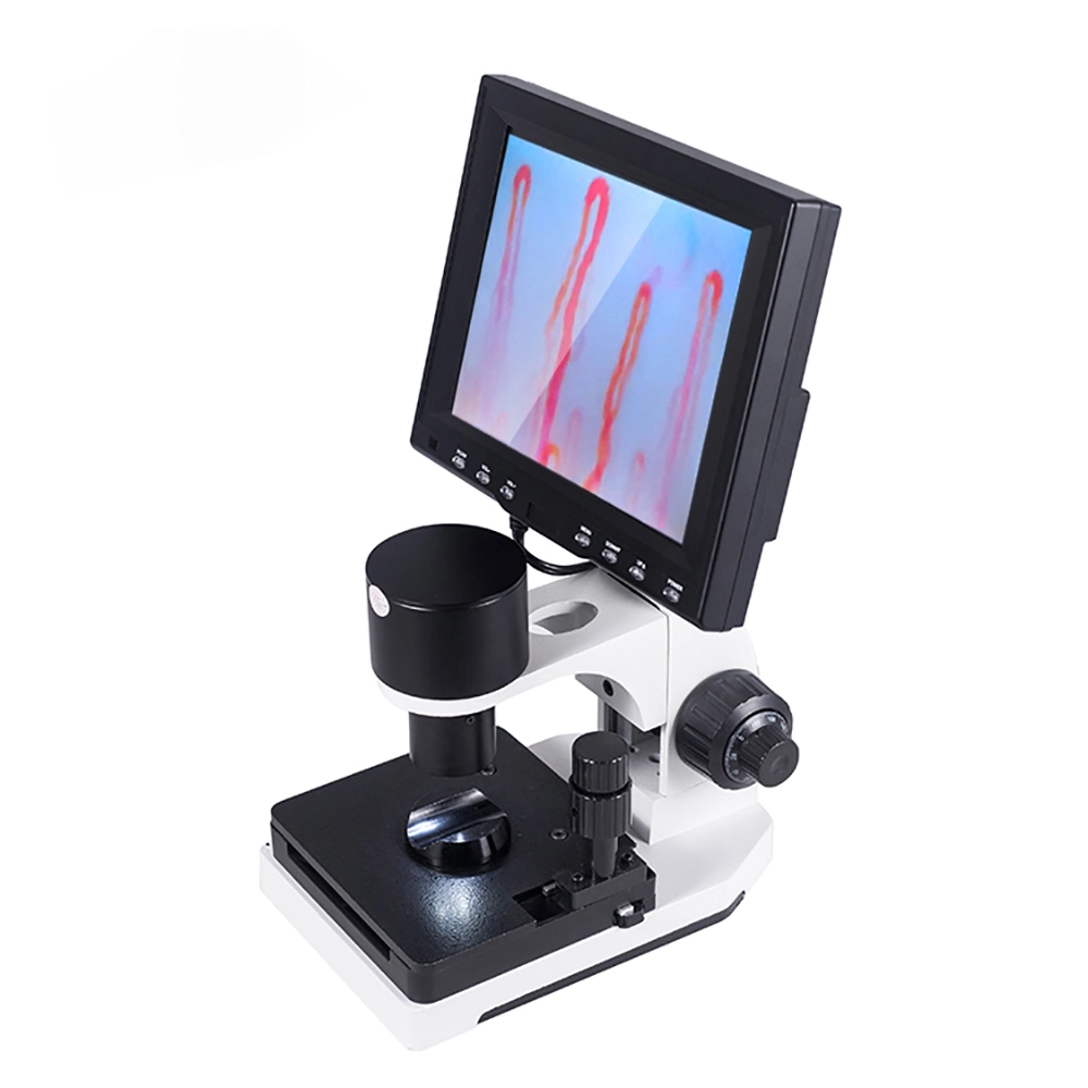 Blood Microcirculation Test Machine Nailfold Capillary Microscopy