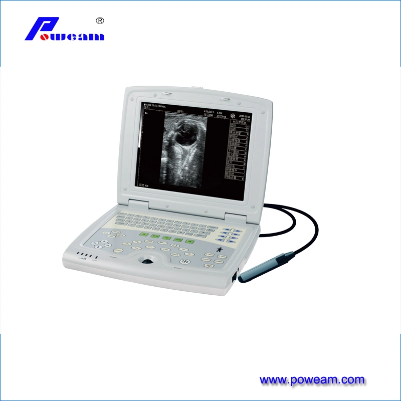 Full Digital Ultrasound Scanner with Ce