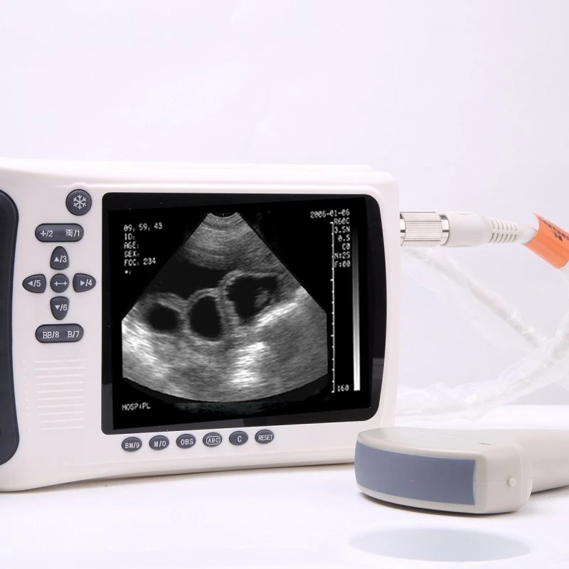 Medco Medical Equipment Veterinary Digital Handheld Ultrasound Machine Ultrasound Scanner
