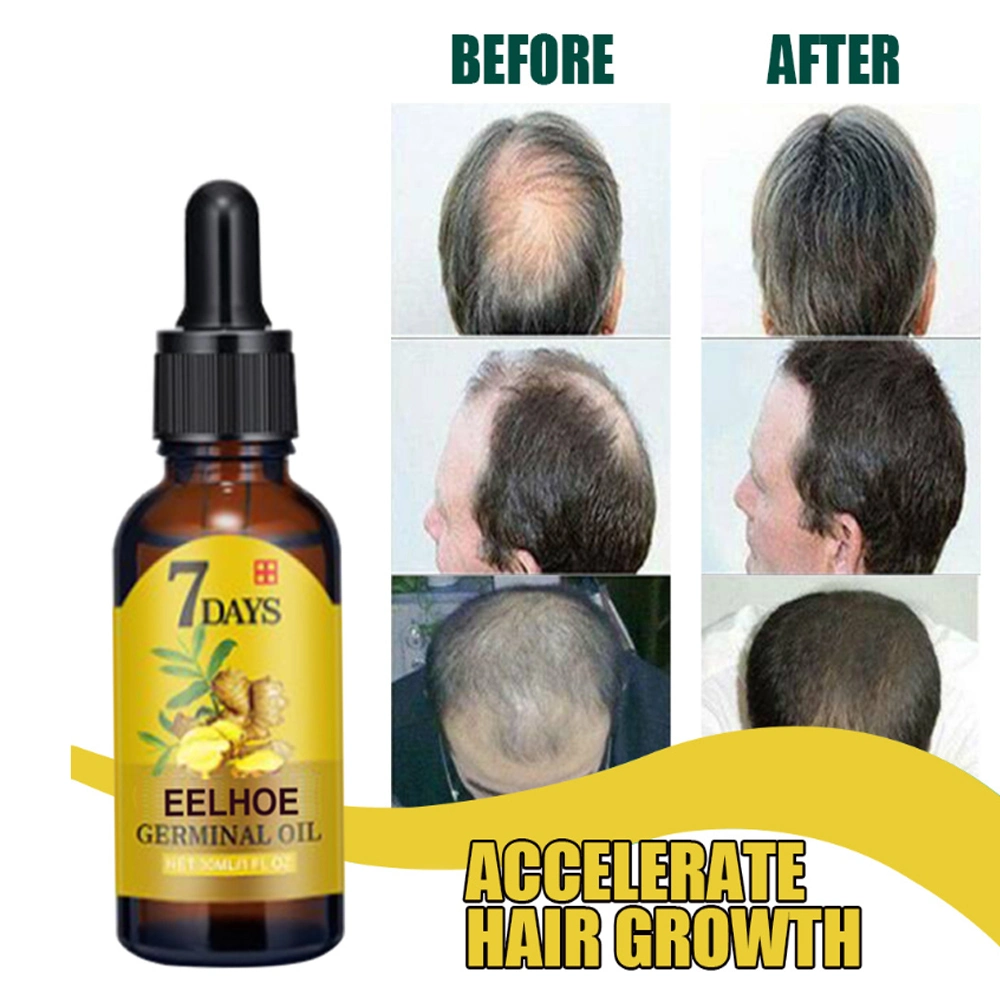 Hair Growth Ginger Extract Solution for Hair Care