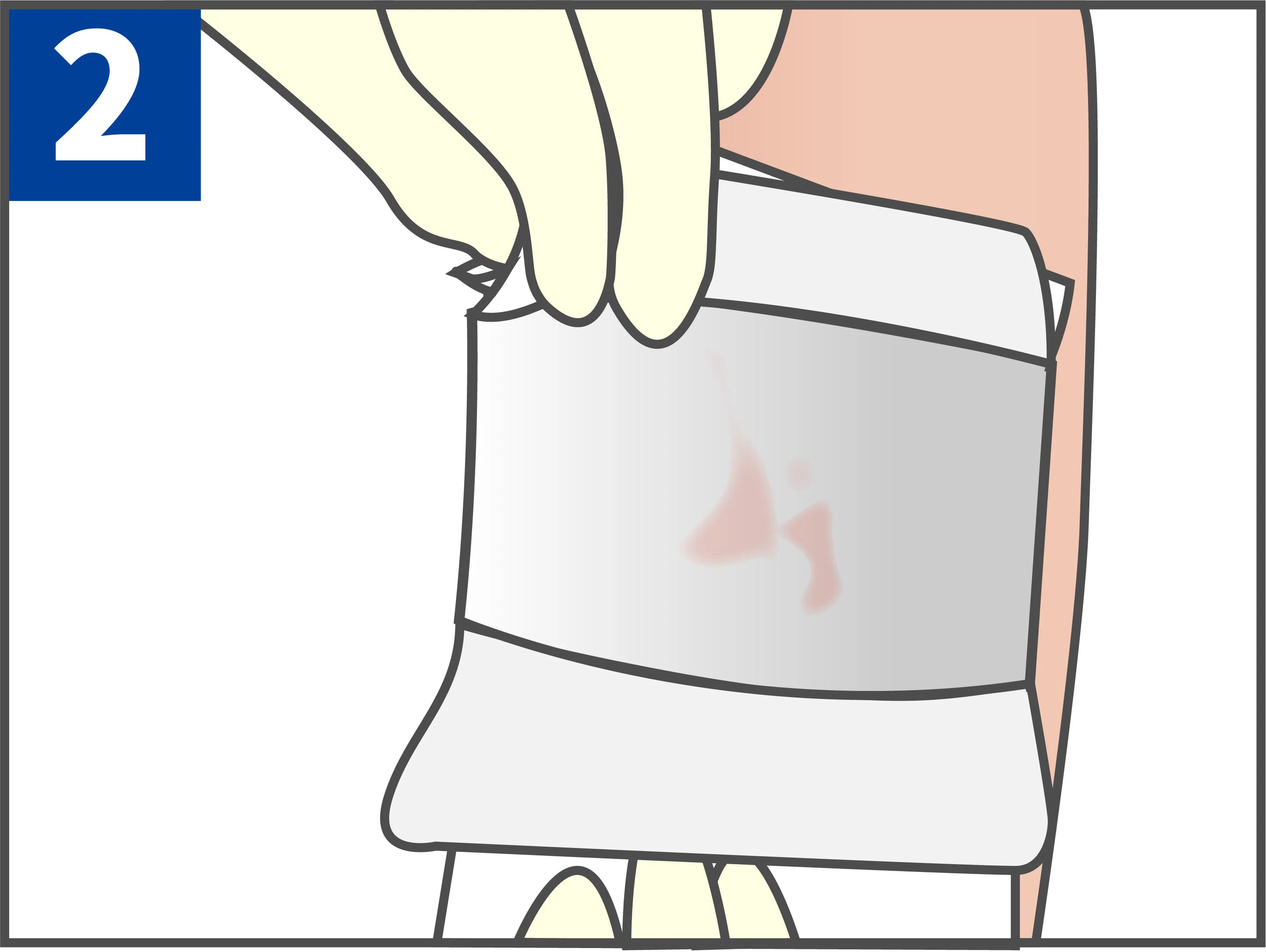 Disposable Medical Sterile Dressing with Low Dressing Change Injury